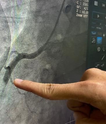 chest-pain-dr-sayan-sen-1