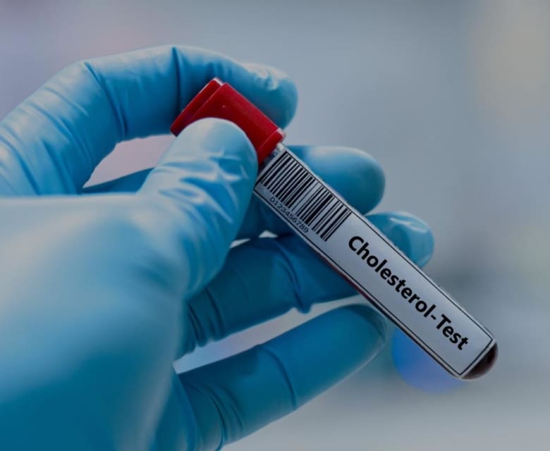 cholesterol-dr-sayan-sen